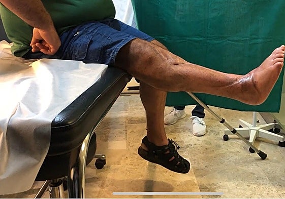 El paciente al que Cavadas ha operado.