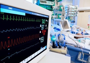 Una IA detecta infartos invisibles con un electrocardiograma con el doble de precisión que el ojo humano