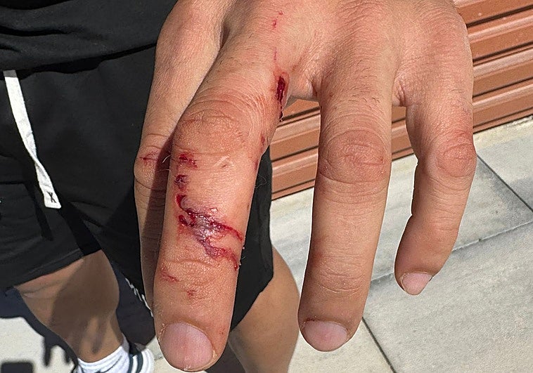 Un policía fuera de servicio rescata a un perro pequeño de las mandíbulas de otro de presa en Pinedo