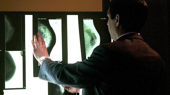 Un médico observa varias mamografías.