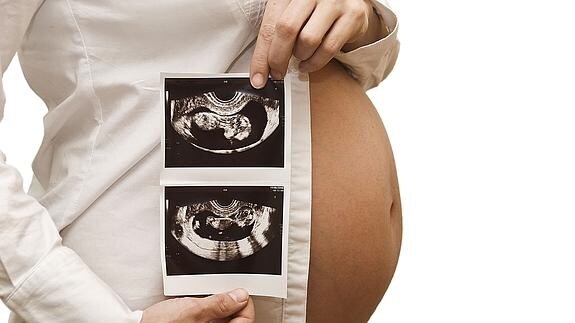 Una embarazada muestra dos ecografías de su bebé.