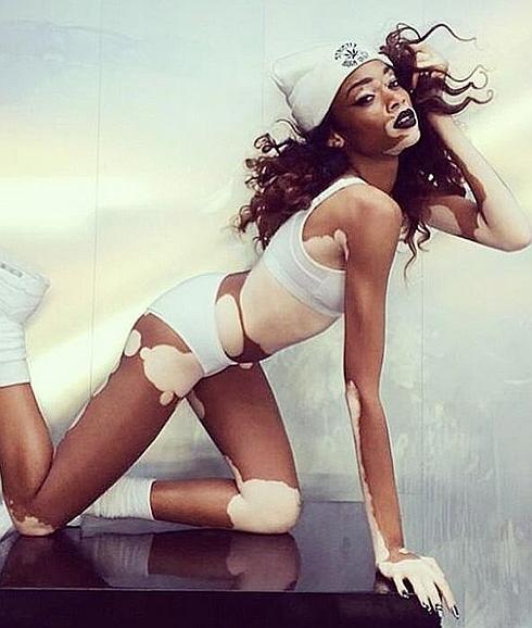 Winnie Harlow, la primera modelo con vitíligo