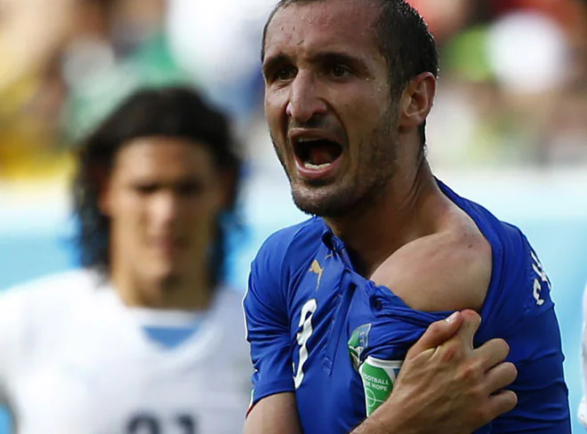 Chiellini muestra al árbitro las marcas de los dientes de Suárez.