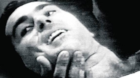 Paquirri pidió un vaso de agua para enjuagarse la boca antes de ser intervenido por el cirujano.