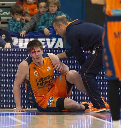 Harangody, con la ceja abierta. :: acbmedia/miguel ángel polo