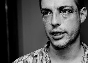 La víctima de la brutal agresión, ayer, con la cara todavía hinchada por los puñetazos que recibió. ::                             TXEMA RODRÍGUEZ