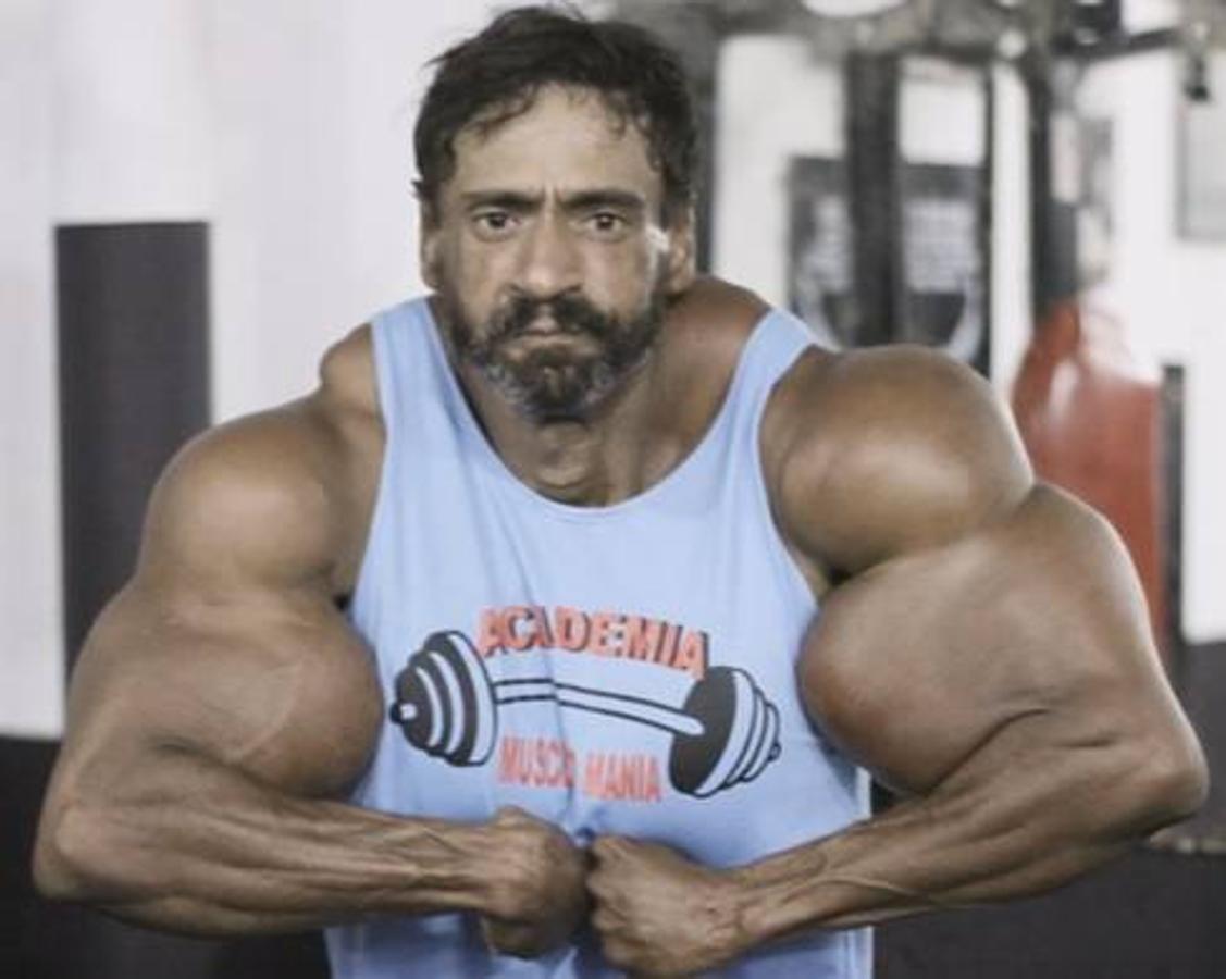 Valdir Segato, el &#039;Hulk&#039; brasileño que se inyecta aceite en los bíceps