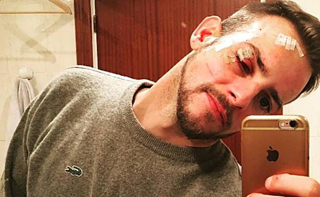 Álex recibió 12 puntos de sutura tras el altercado