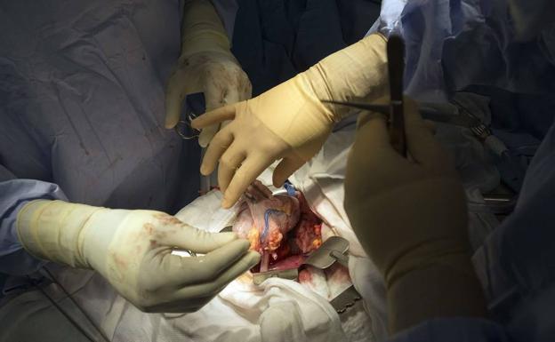 Un cirujano prepara un riñón donado para transpantarlo, en Nueva York. 
