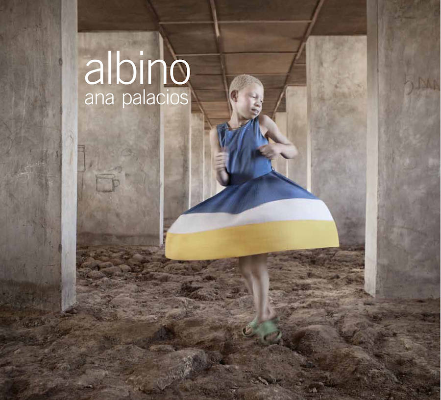 La fotógrafa Ana Palacios denuncia en el Museo Molinos del Río de Murcia el drama de los negros albinos de Tanzania