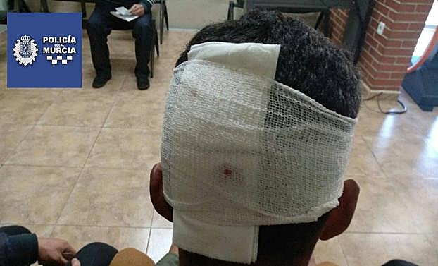 Uno de los agredidos tras ser atendido por los sanitarios.