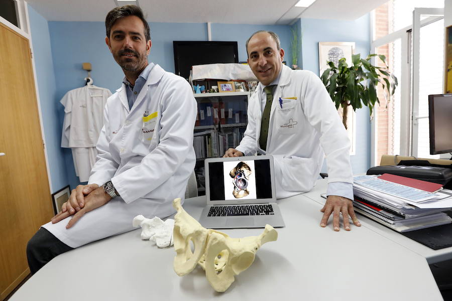 16/06/2018. Prótesis 'a la carta' en La Arrixaca. El hospital utiliza por primera vez tecnología 3D para diseñar un implante de cadera a la medida de un paciente. 