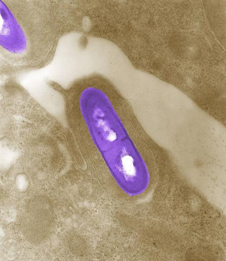Imagen - Bacteria de listareia. / Reuters
