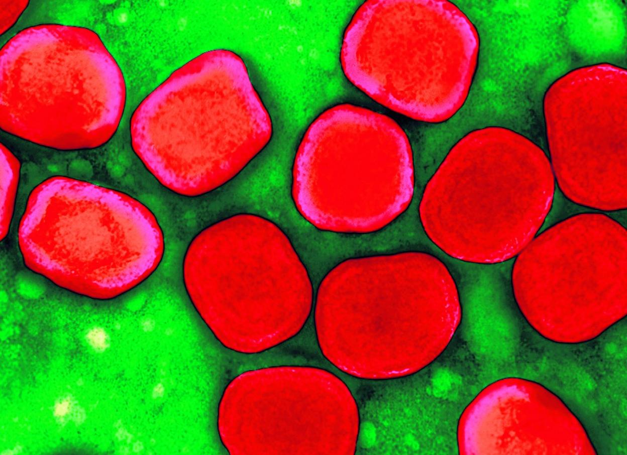 Imagen del virus de la viruela (Variola) coloreada de forma artificial y tomada con un microscopio electrónico. 