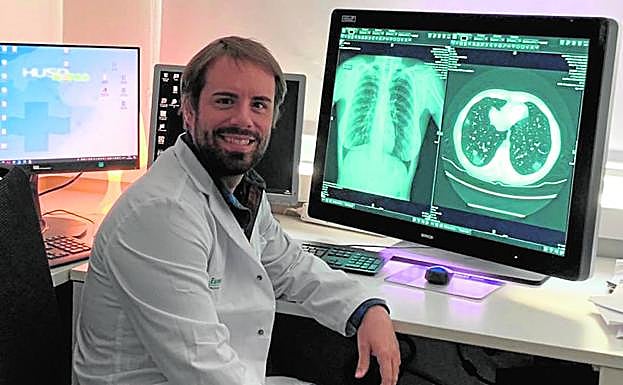 Pau Camarasa Guijarro (Murcia, 1985), médico adjunto de Radiología en el Hospital General Universitario Son Espases (Palma de Mallorca).