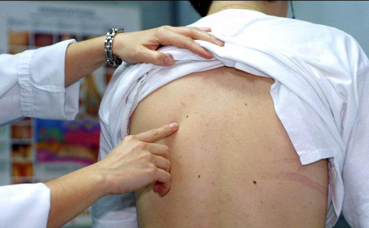 Exploración de lunares en la consulta de un hospital, en una fotografía de archivo.