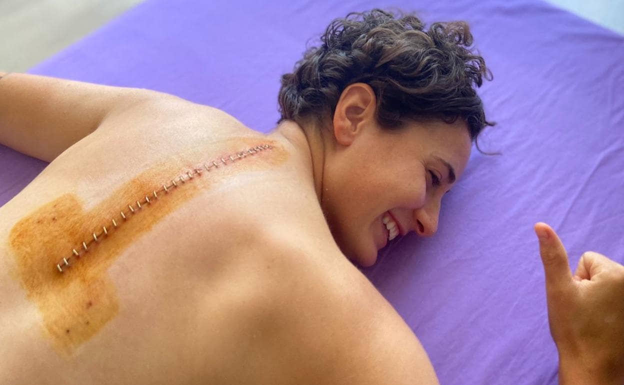 Ana Carrasco muestra su cicatriz tras la operación.