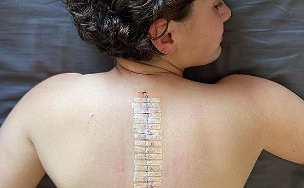 24 de septiembre de 2020. Ana Carrasco muestra la cicatriz, tras ser operada. 