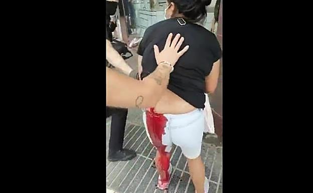 La agredida es atendida por varios policías. 