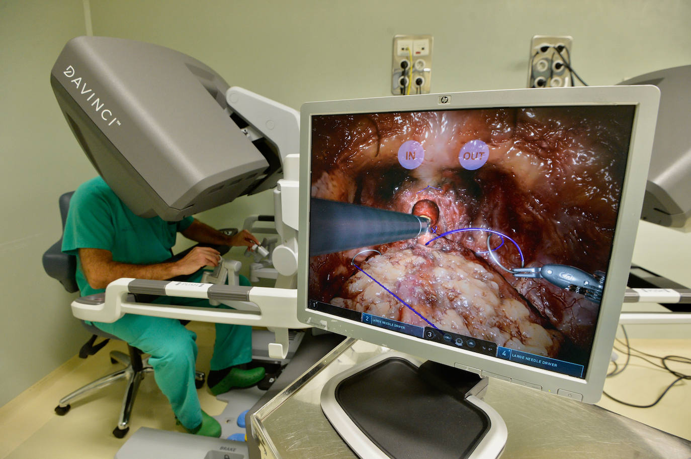 Fotos: Un robot en el quirófano