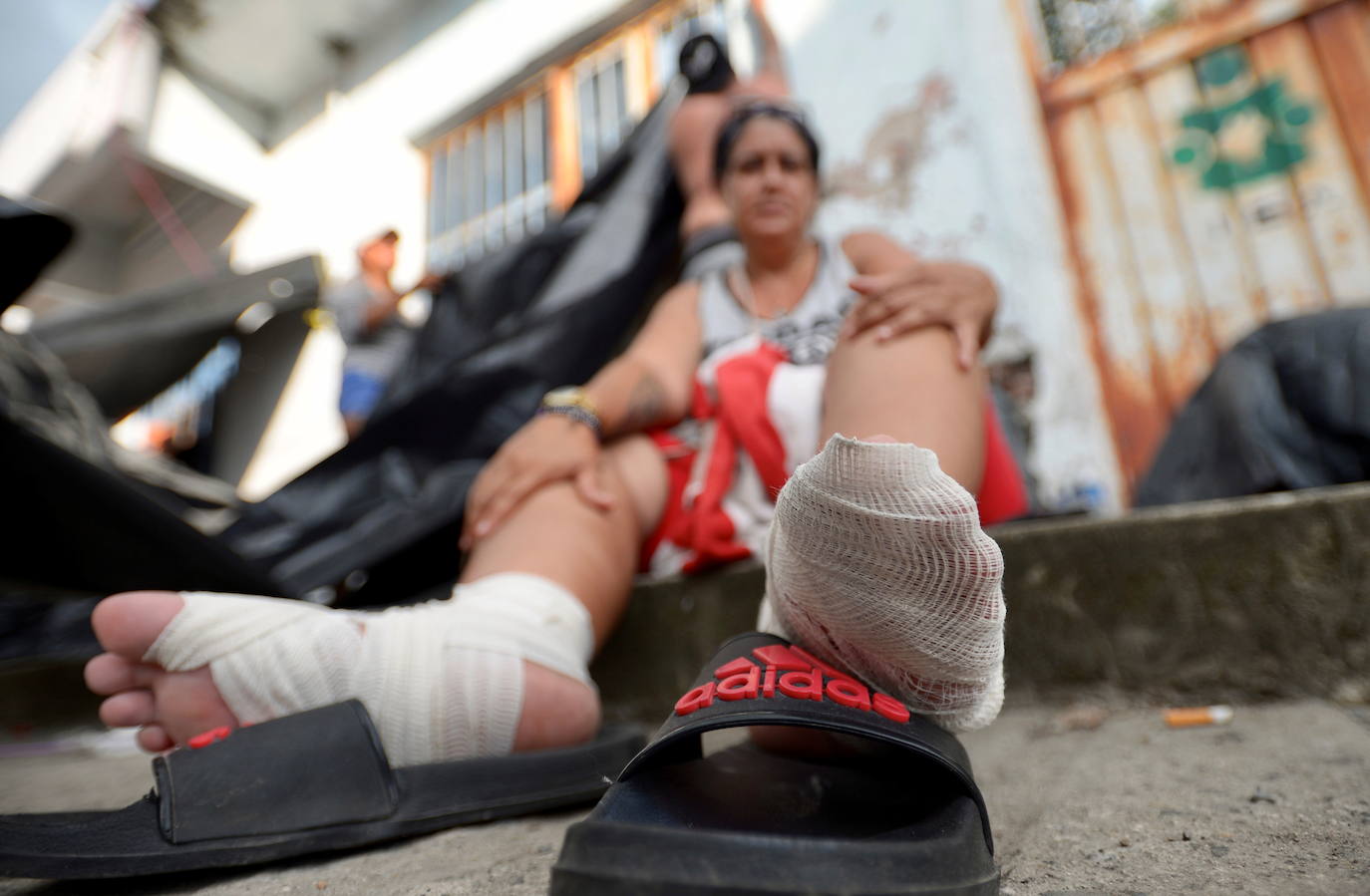 Fotos: Vendas y reposo