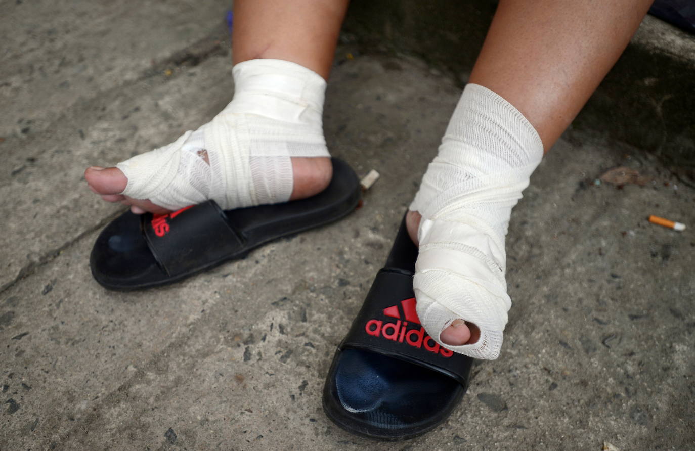 Fotos: Vendas y reposo