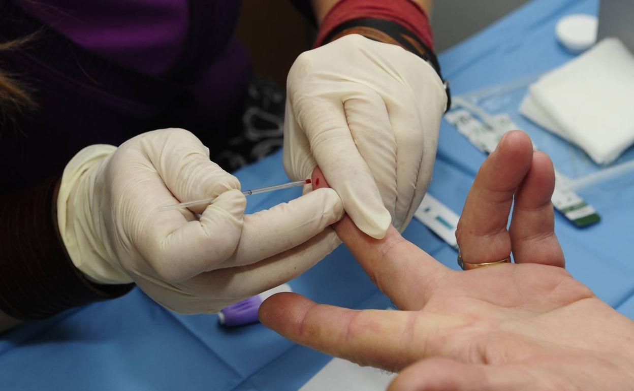 Prueba para detectar el VIH en una imagen de archivo. 