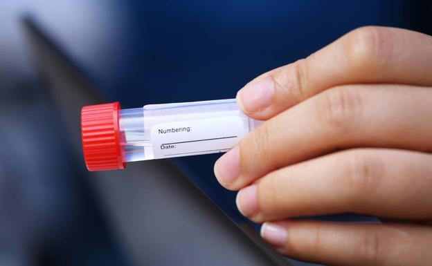 Científicos de la UMU validan una prueba para estimar la gravedad de pacientes Covid