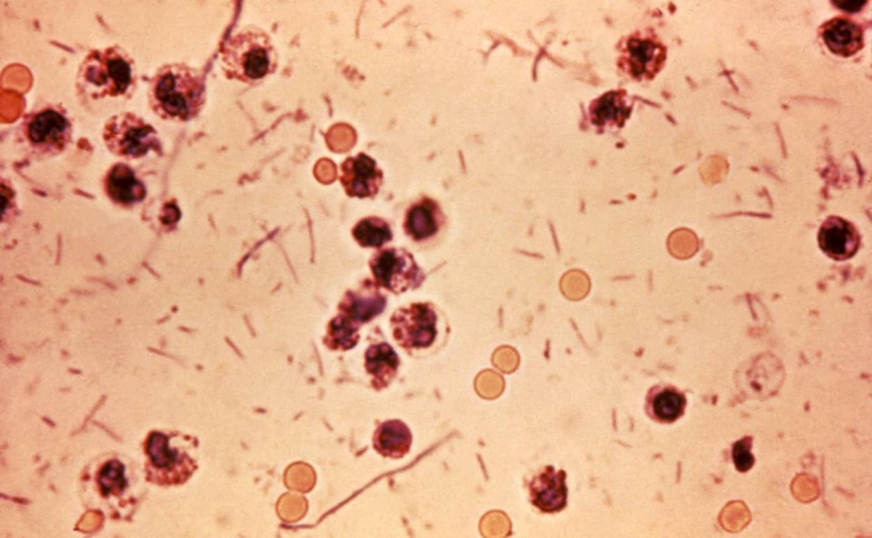 Trinción de Gram de la bacteria Shigella