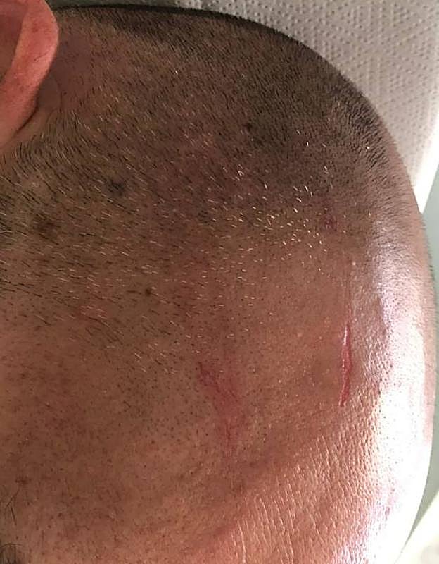 Herida del médico en la cabeza.