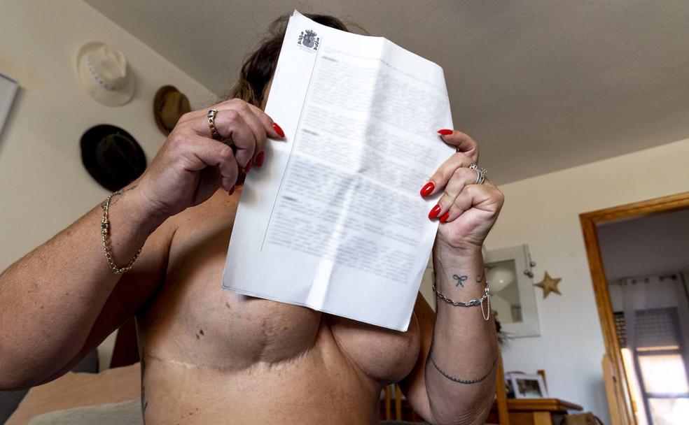 M. P. muestra en su casa de Cartagena la cicatriz que le ha quedado tras más de una decena de intervenciones de mama.