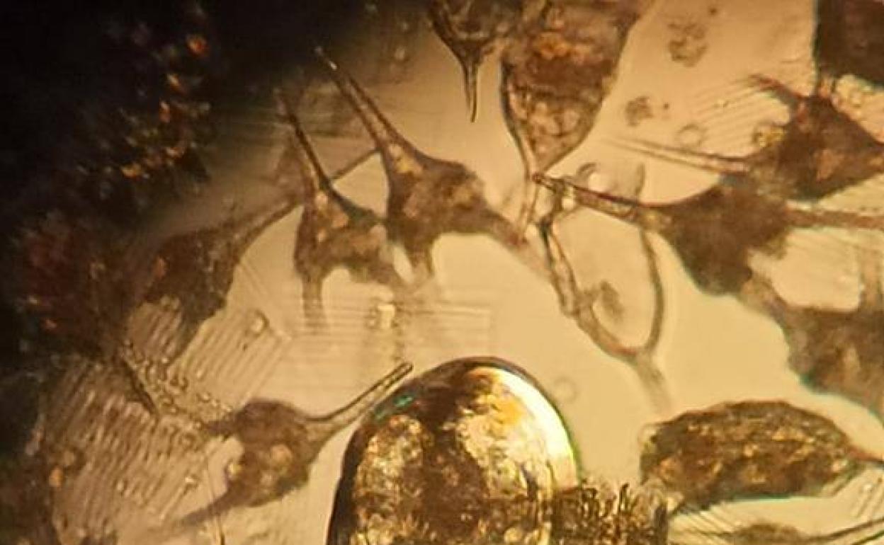 Larvas de mejillón cebra detectadas en el embalse del Cenajo, ampliadas al microscopio.