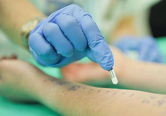 Una prueba de alergia.