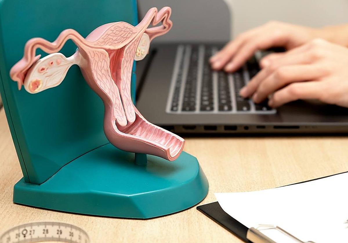 Edad avanzada, obesidad, no tener hijos o tener el primero más allá de los treinta y cinco, factores de riesgo más frecuentes del cáncer de ovarios