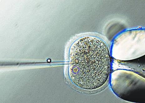 Imagen secundaria 1 - Microinyección de un ovocito de ratón.