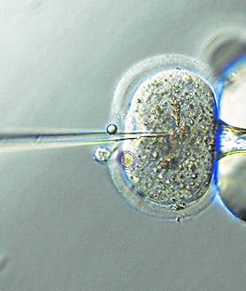 Imagen secundaria 2 - Microinyección de un ovocito de ratón.