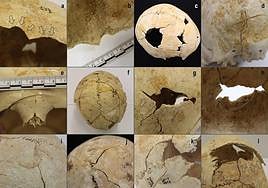 Ejemplos de cráneos con distintas lesiones.