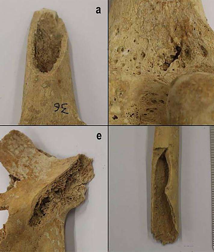 Imagen secundaria 2 - El enterramiento masivo en la Rioja alavesa antes de su excavación y la distribución de los principales restos óseos. Diferentes piezas óseas rescatadas. 