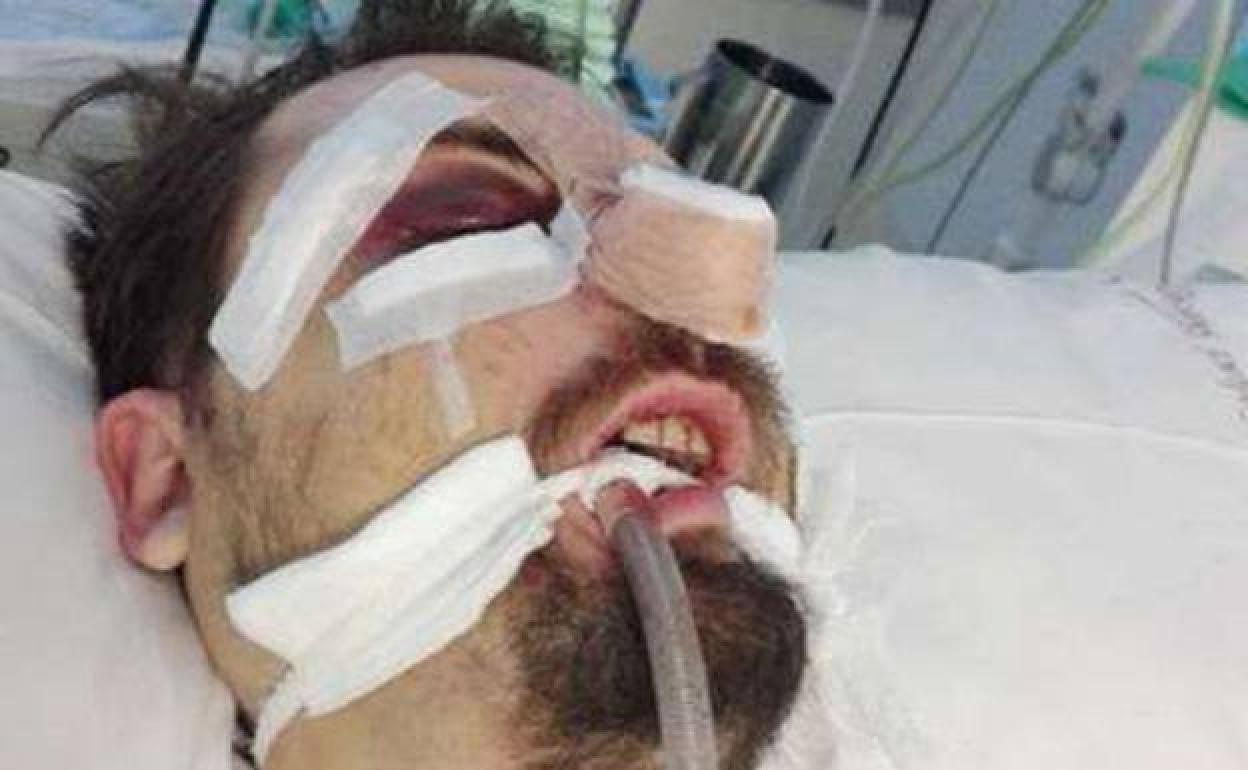 La víctima, cuando se encontraba ingresada en la UCI. 