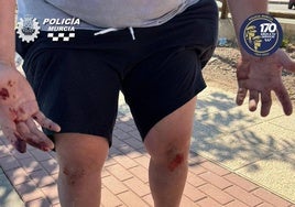 El resultado de la agresión al hombre.