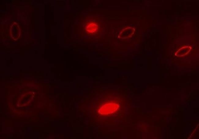 Estomas vistos al microscopio.