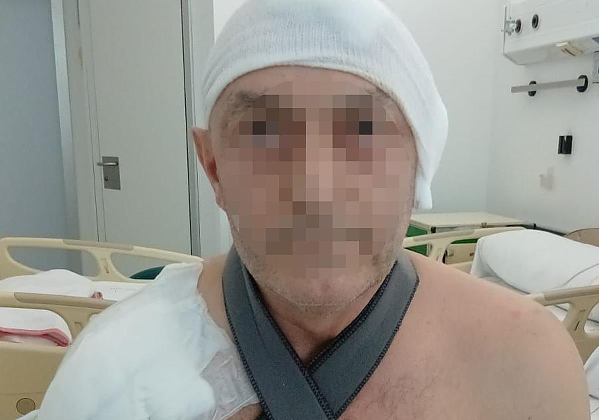 La víctima muestra sus vendajes mientras se recupera en el hospital Reina Sofía.
