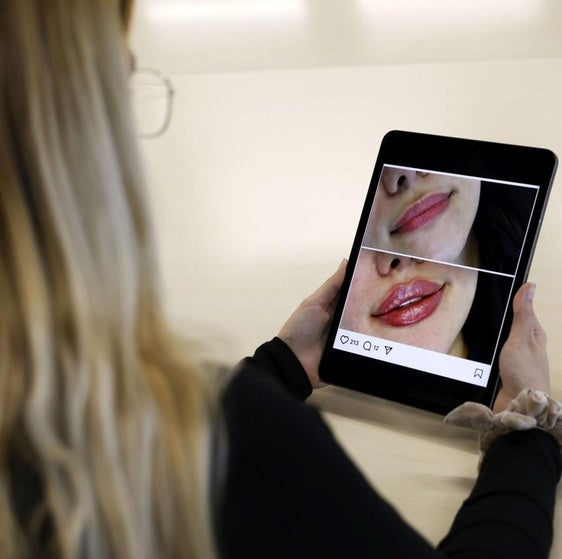 El auge de los retoques estéticos en jóvenes: «Hay chicas pidiendo parecerse a un filtro»