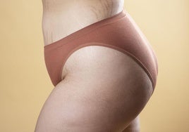 Cuerpo de una mujer con estrías.