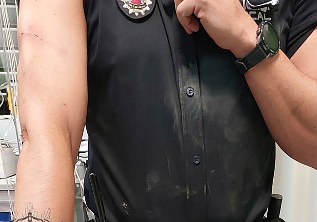 Un agente muestra las lesiones causadas en un brazo.