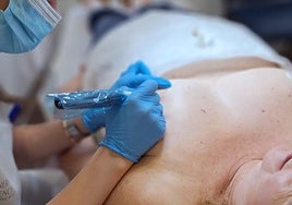 Proceso de micropigmentación mamaria.