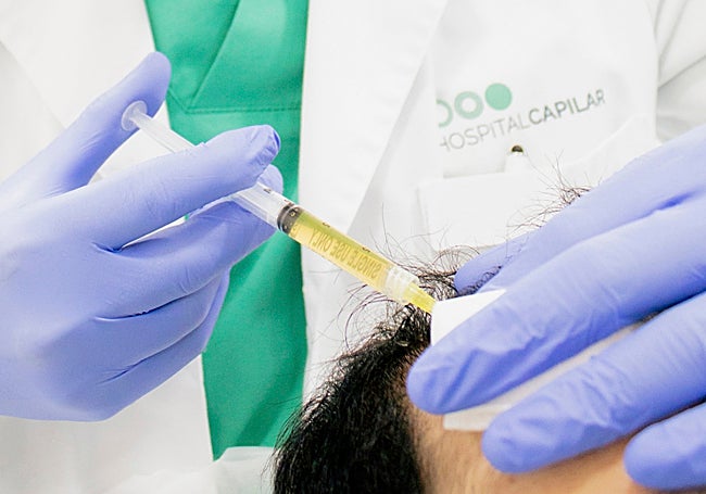 Hospital Capilar ofrece tratamientos personalizados y eficaces para combatir la pérdida capilar.