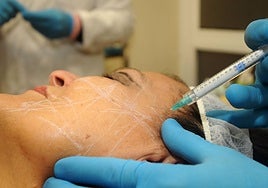 Una paciente recibe una infiltración de ácido hialurónico.