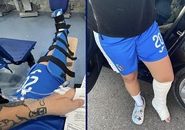 Dos jugadoras del Águilas muestran sus lesiones tras el partido.