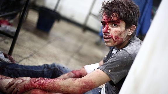 Un joven herido durante los bombardeos al noroeste de Damasco. 